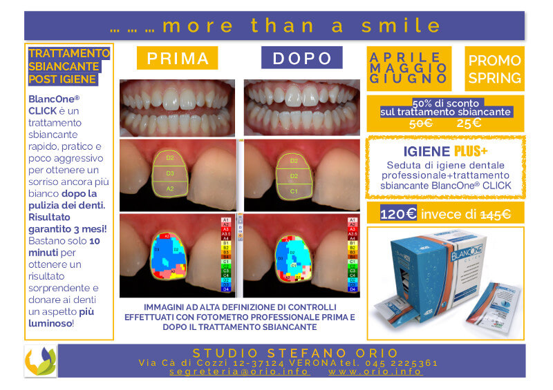 News Studio Orio Dentista a Verona